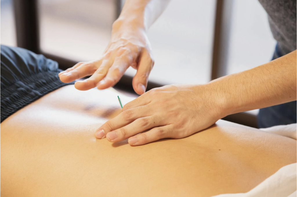 Acupuncture therapy is very effective for sports injuries